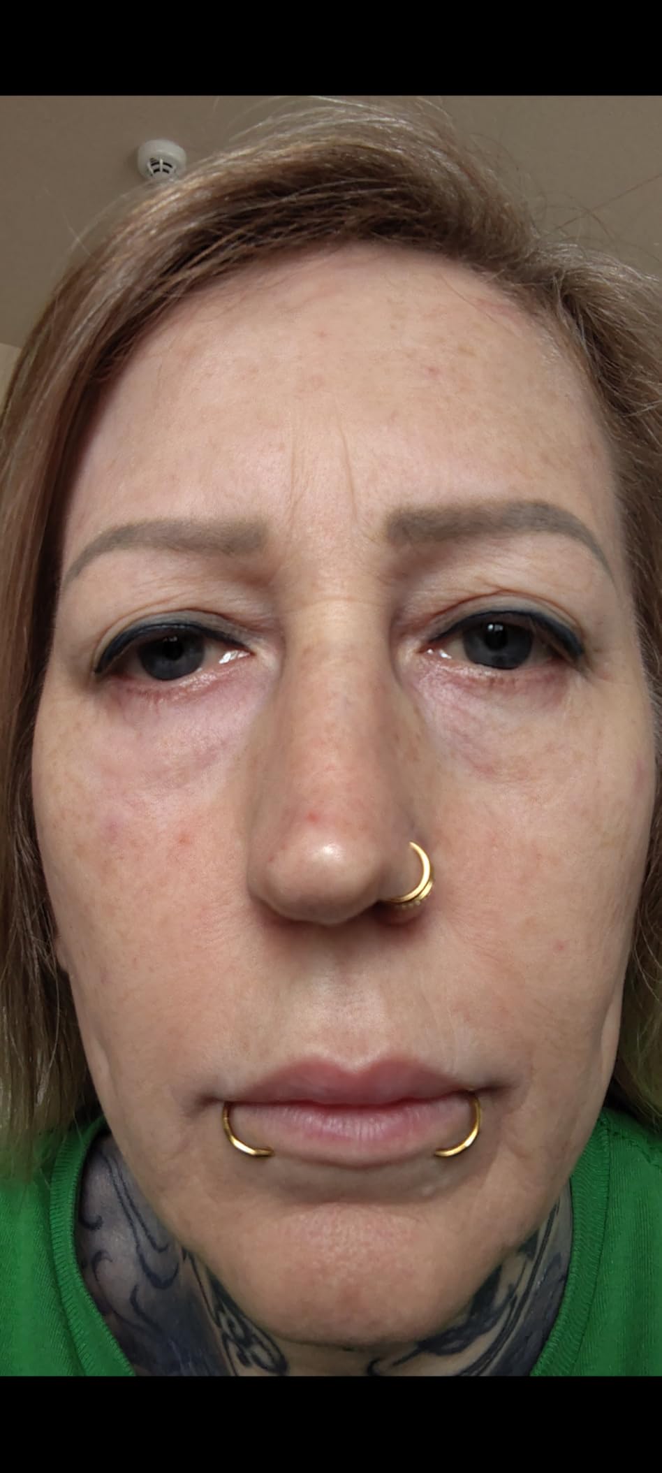 Customer Image