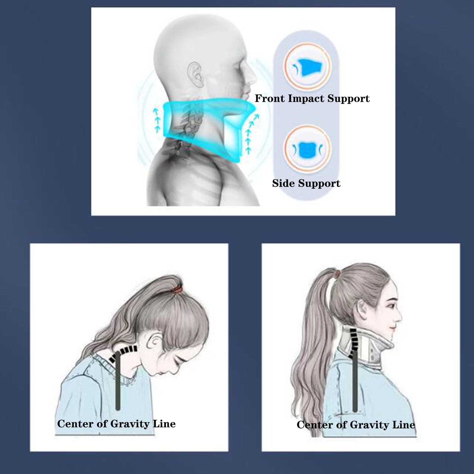 SFKLYU Ortesis Cervical Torácica Halo Brace Collar Cervical Ajustable Ortesis Diseño Abierto Ortesis Cervical Torácica Brace para Alivia el Dolor y la Presión en la Columna Vertebral