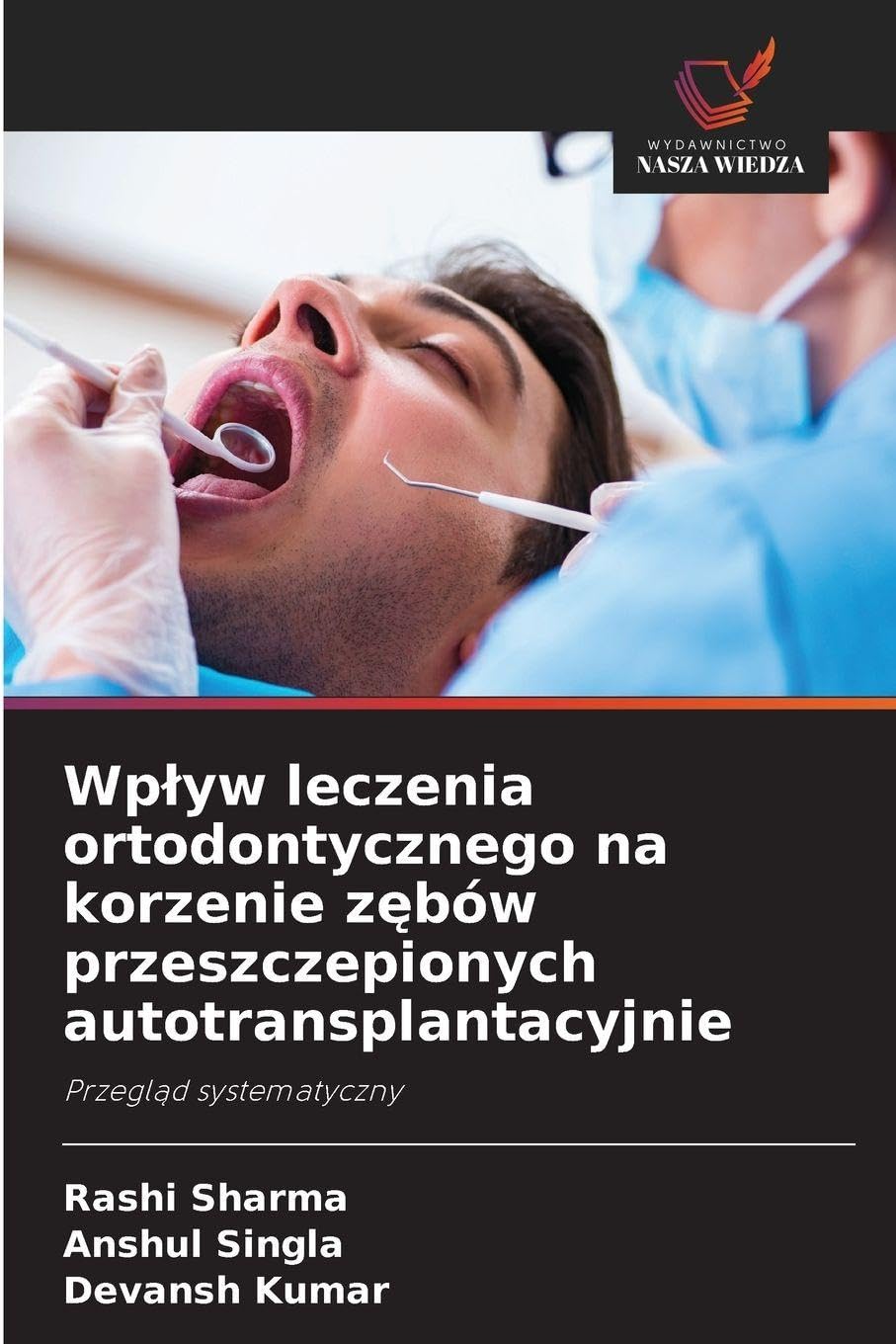 Wplyw leczenia ortodontycznego na korzenie zębów przeszczepionych autotransplantacyjnie: Przegl¿d systematyczny