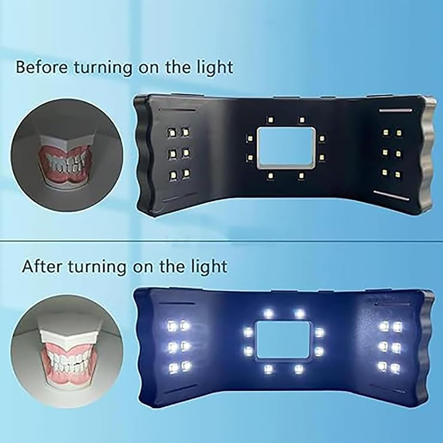 Kit di luci per fotografia dentale con luminosità regolabile per assistenza fotografica orale