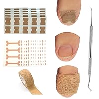 Vista 11 de Tratamiento de uñas encarnadas, 50 calcomanías de corrección de uñas encarnadas, parches correctores de uñas de los pies, herramienta profesional