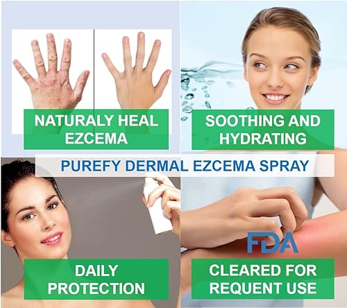 Miniatura 4 de PUREFY Spray para eccema dérmico (4 onzas, 2 unidades) de curación natural. Tecnología de limpieza dérmica Purefypro. Seguro para niños y todos.