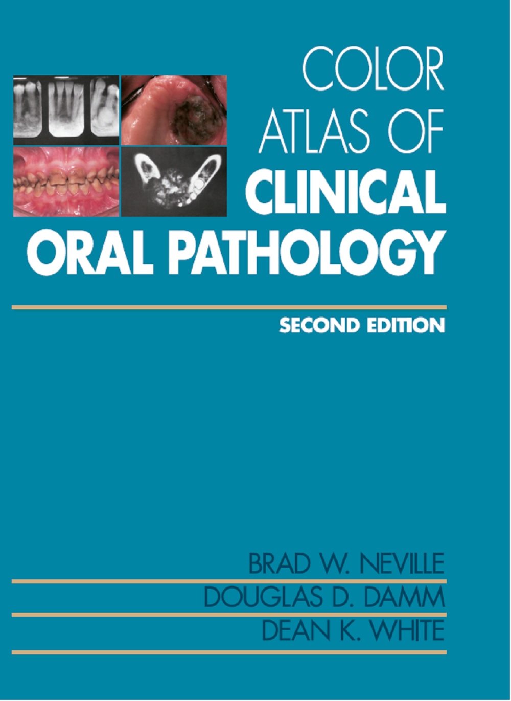 Color Atlas of Clinical Oral Pathology Kindle edition by Neville
