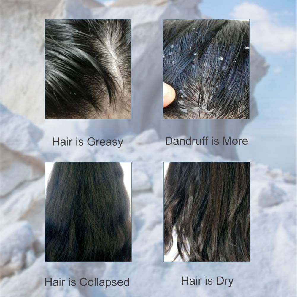 Psoriasis Shampoo, AntiDandruff Shampoo, Sea Salt Shampoo, Itchy Scalp Treatment Shampoo for