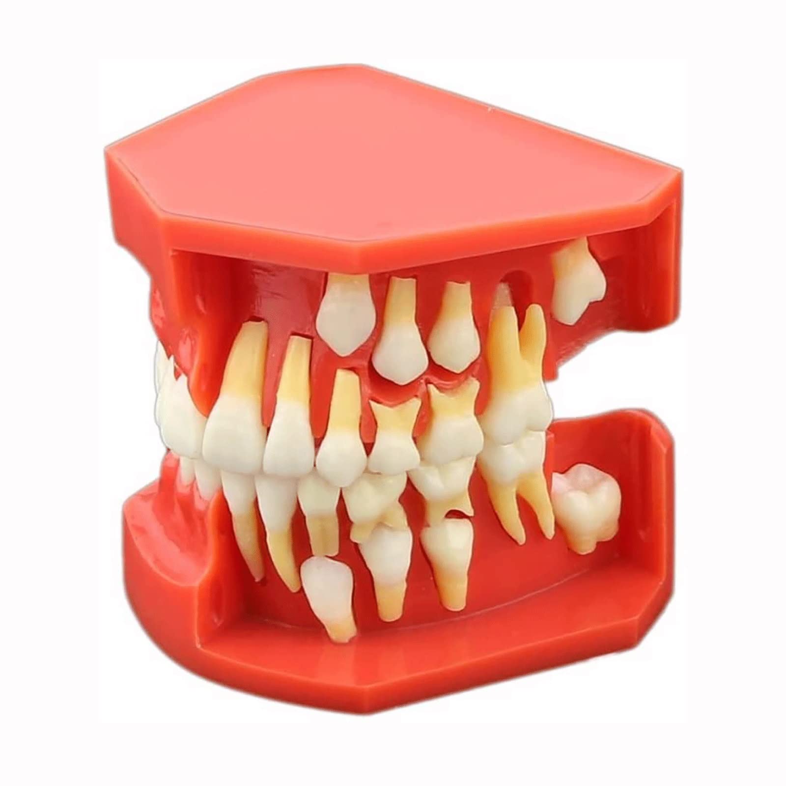 Modelli di Insegnamento Dentale, Modello di Dimostrazione Dentale per Denti Rimovibili per Malattie Dentali Modello per La Cura dei Denti Dentali per Bambini di 9-12 Anni