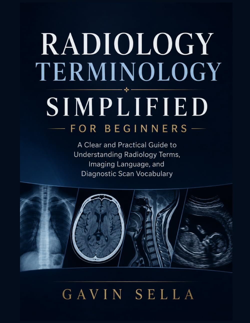 Radiology Terminology Simplified For Beginners: A Clear and Practical Guide to Understanding Radiology Terms, Imaging Language, and Diagnostic Scan Vocabulary