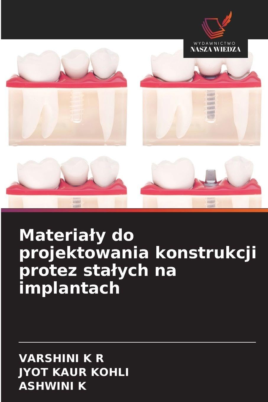 Materia¿y do projektowania konstrukcji protez sta¿ych na implantach