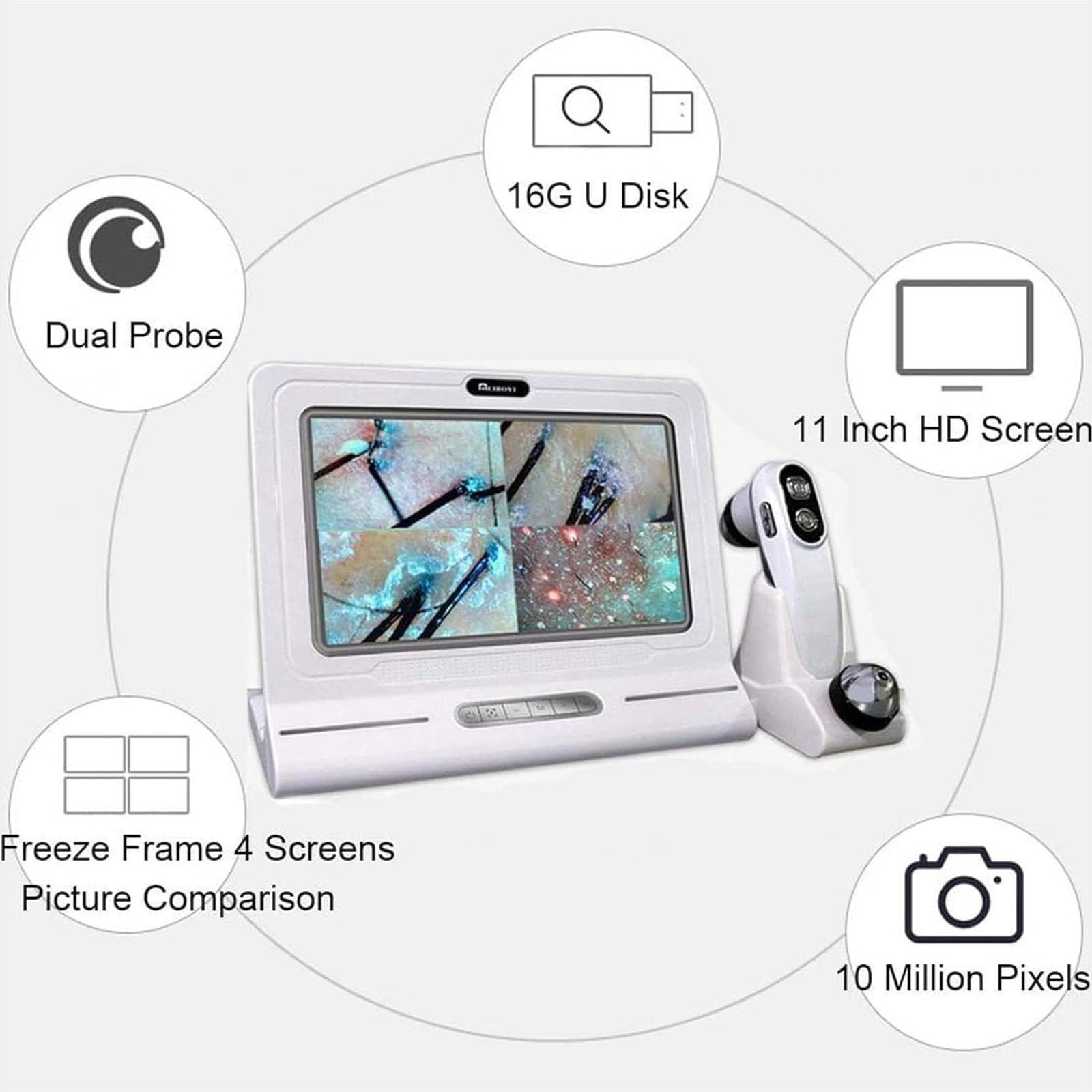 Analizzatore Capelli E Pelle Microscopio Digitale LCD 11 in Portatile per Rilevatore Cuoio Capelluto,Rilevatore di umidità Olio per Follicoli Piliferi Tester per Pigmenti Pelle