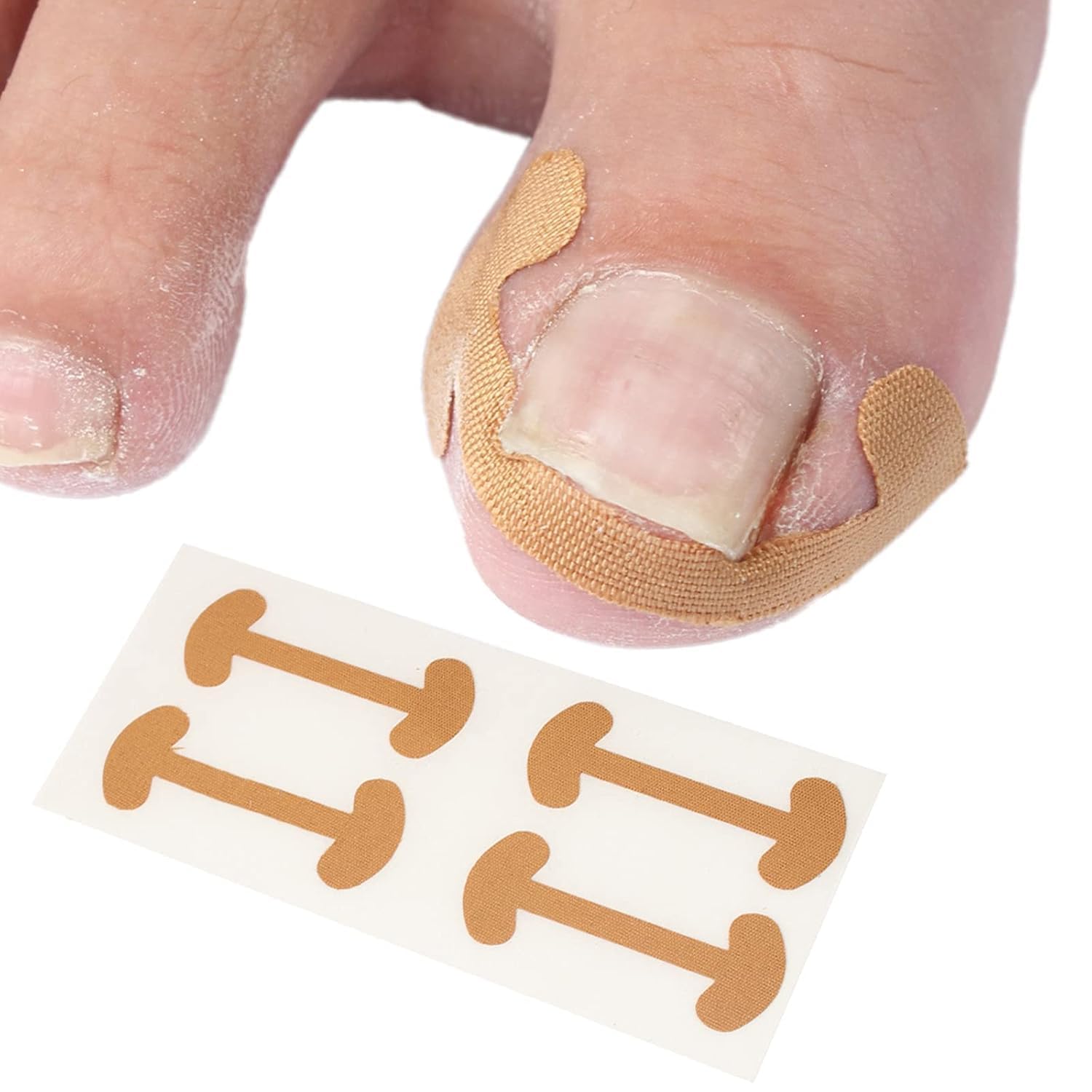 DK ZONE Ingrown Toenail Correction Patches Nail Straightening Sticker Adhesive Nail Corrector Strip for Curved Nails Toenail Care Pain Relief Daily Foot Care,Pack of 5-image-40