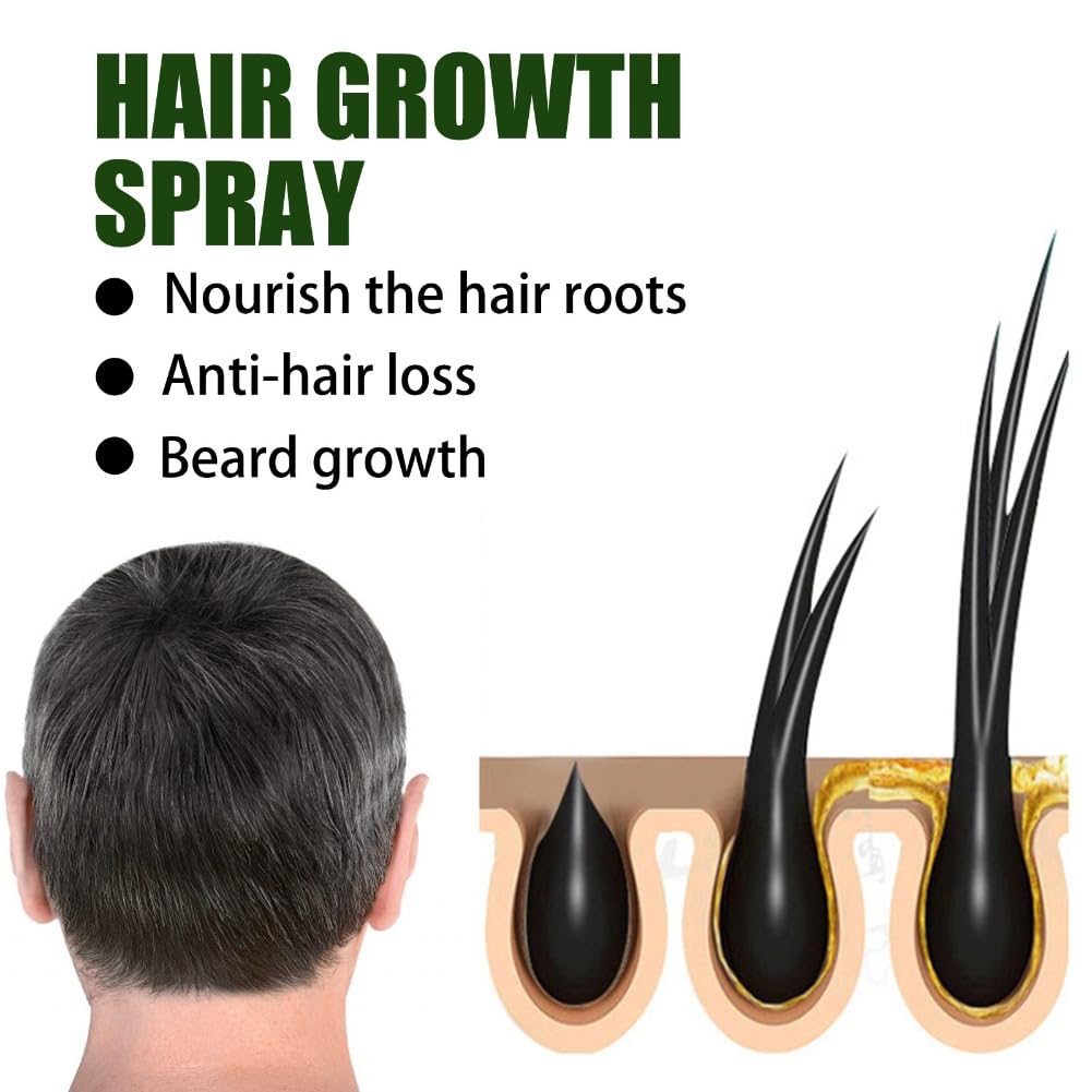2PCS Hair Growth Spray for Anti Hair Loss Fast Treatment Scalp Prevent Hair Thinning Dry Frizzy Conditioning Strong Hair Root