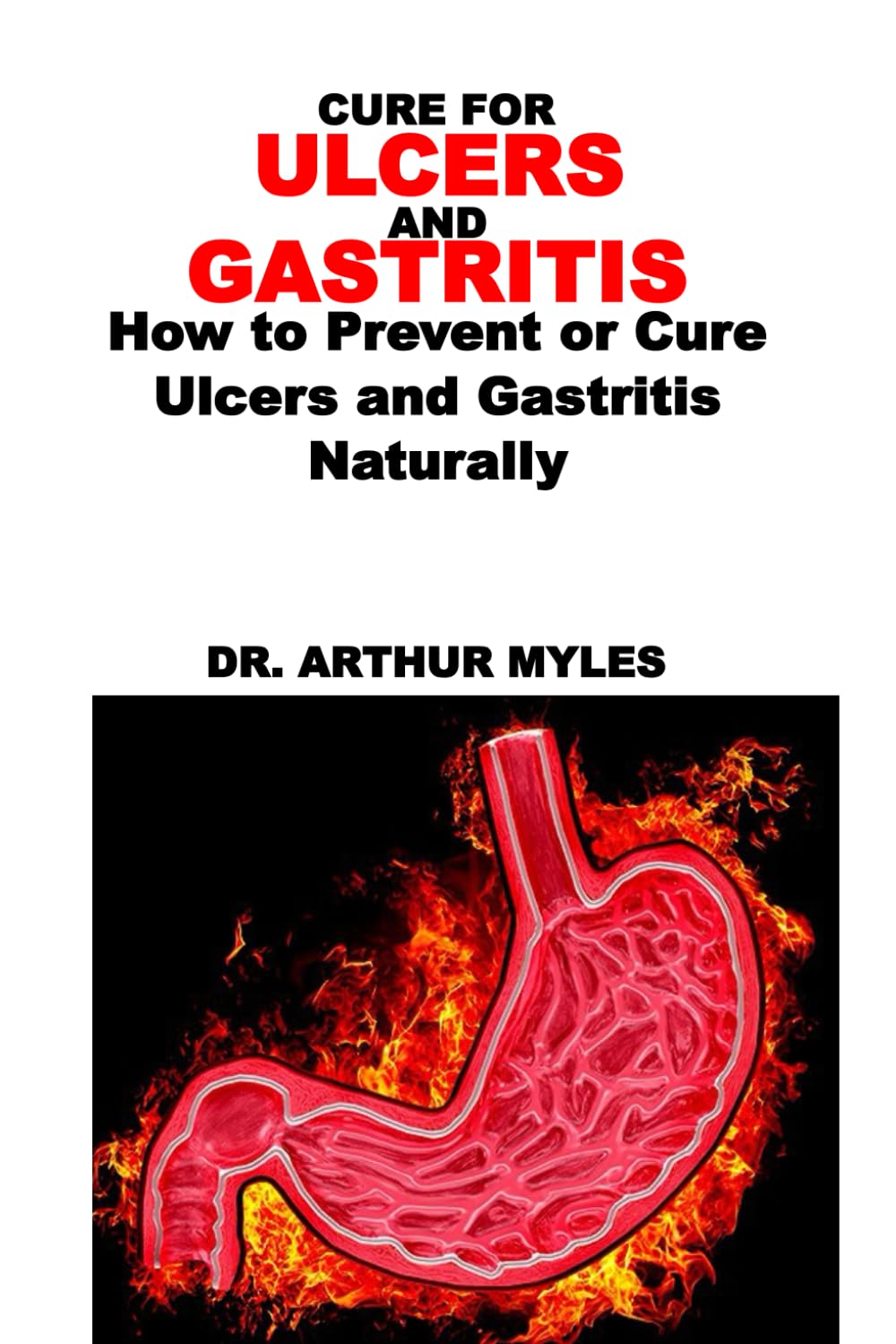 CURE FOR ULCERS AND GASTRITIS: How to Prevent or Cure Ulcers and Gastritis Naturally