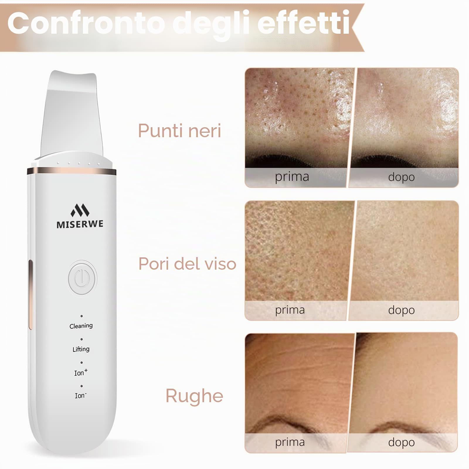 Skin Scrubber Face Skin Spatula - Scrubber per la pulizia profonda dei punti neri