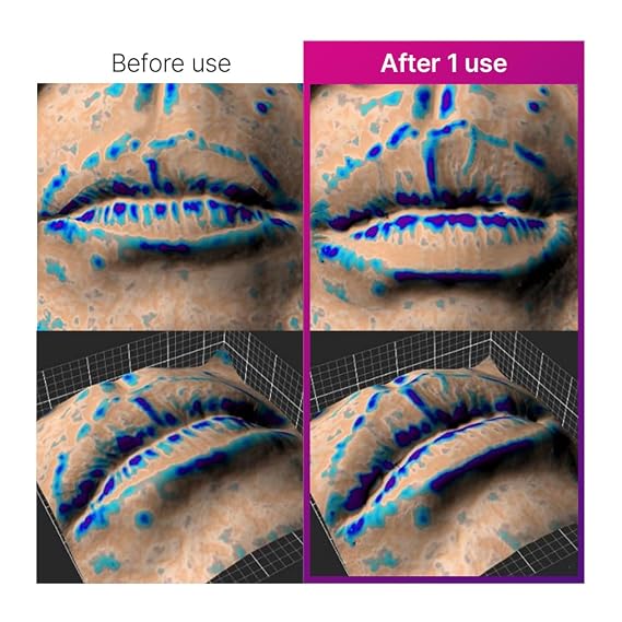 Elishacoy | THE VOLUME Lip Plumper Strong | Volumizing High-Shine Lip Gloss | Fuller-Looking Lips | Vegan Lip Care | 0.14 oz (4 g)