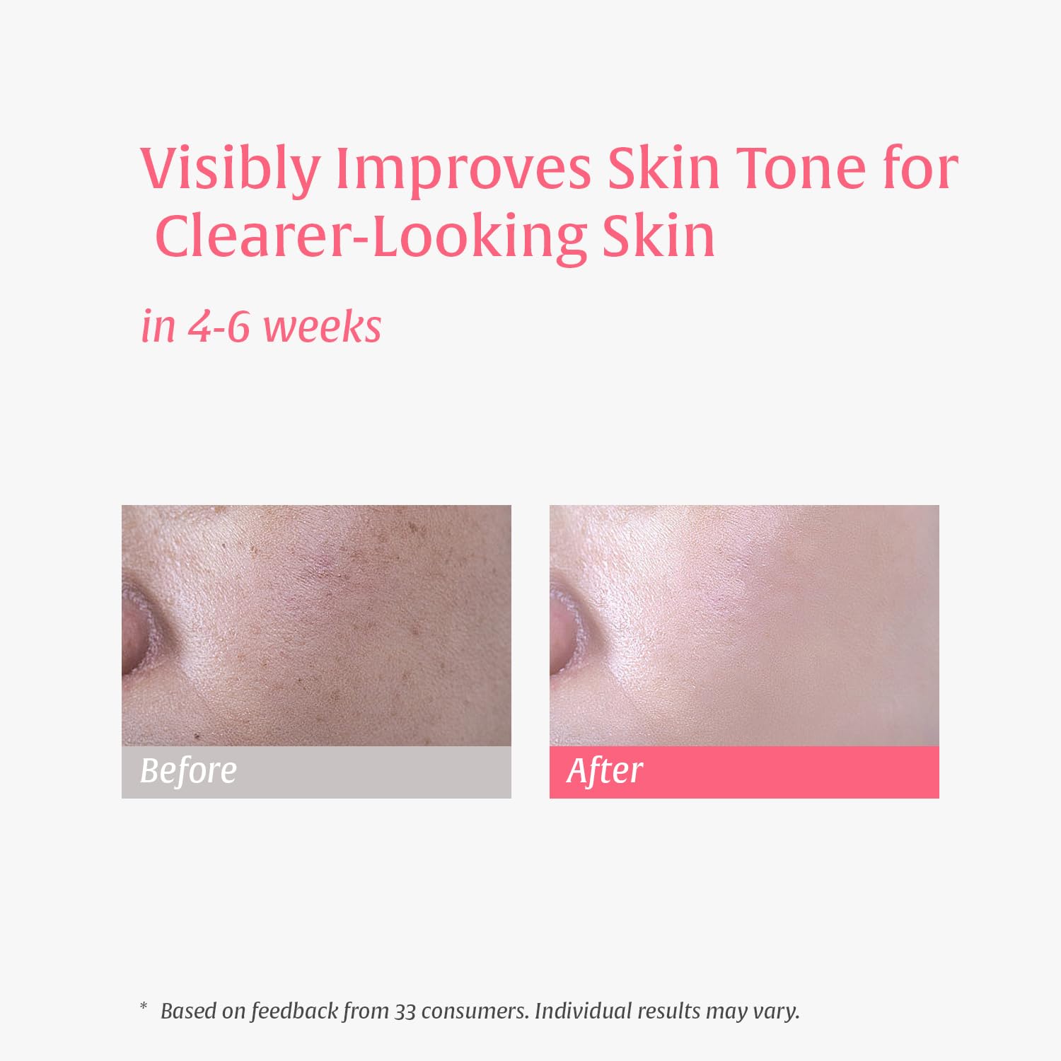 Nutralessece 10% Niacinamide, 4% Tranexamic Acid Serum for Dark Spots, Brightening & Even Skin Tone – Alpha Arbutin & Multi-Hyaluronic Acid Hydrating Essence, for All Skin Types, 1.0 fl oz - Image 4