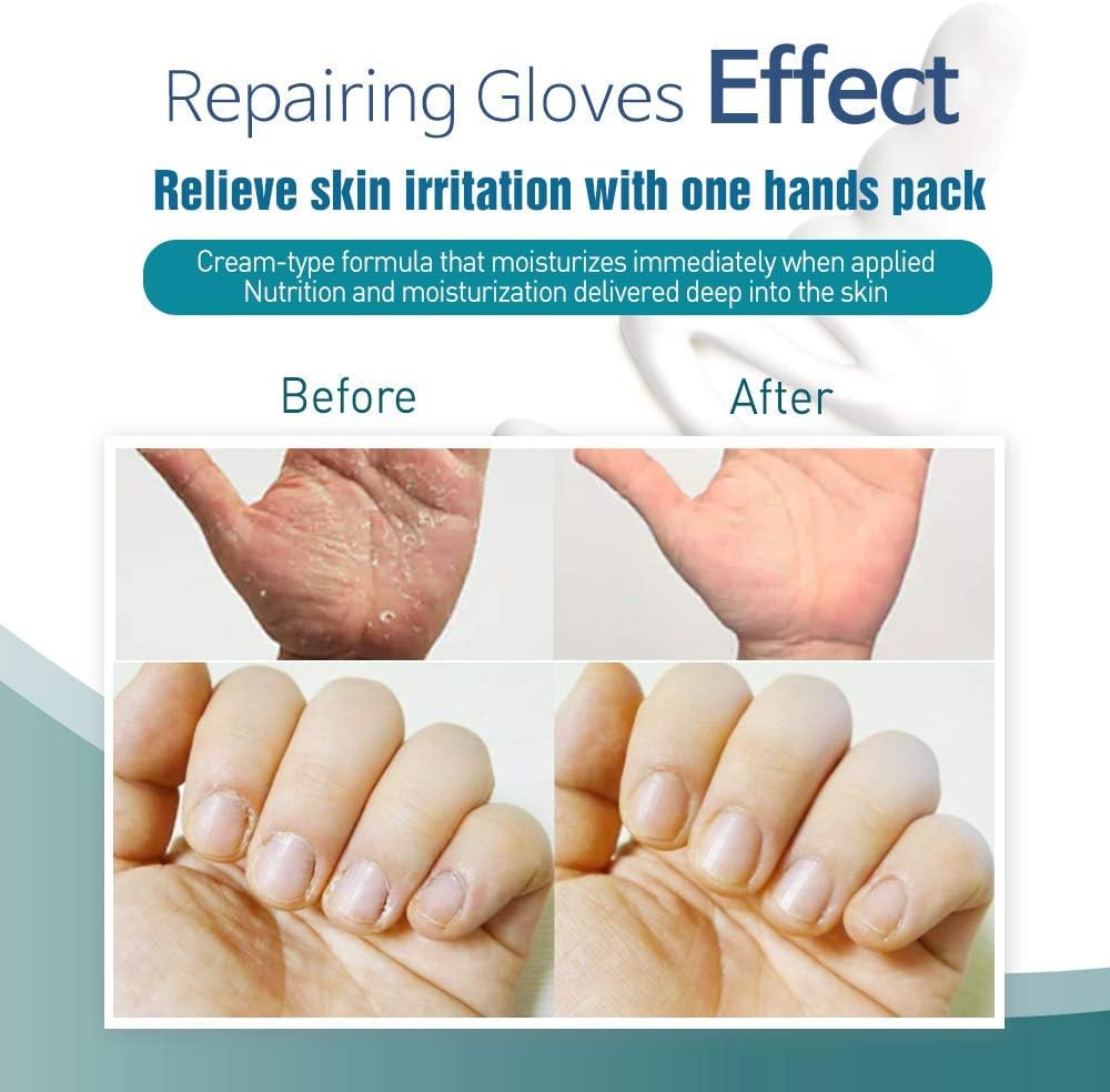 Epiel Intensive Repairing Hand Mask - Pack of 12 | Deep Moisture Gloves for Dry, Cracked Hands | Coconut Oil & Milk Extract Formulated | Korea Skin Care