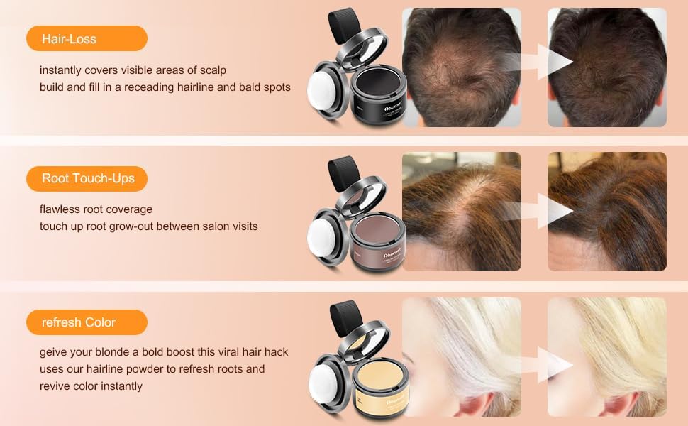 Image of Natural Hairline Powder, Hair Shading Sponge Pen, Hairline Shadow Powder Stick, Quick Root Touch-Up Eyebrow Stamp Root Cover Up Hairline Black Root Touchup 4gm For Women And Men (BLACK, 4G)