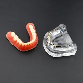 Dental Teeth Model Inferior Overdenture Precision 4 Implants Golden/Silver Bar (M6008S)