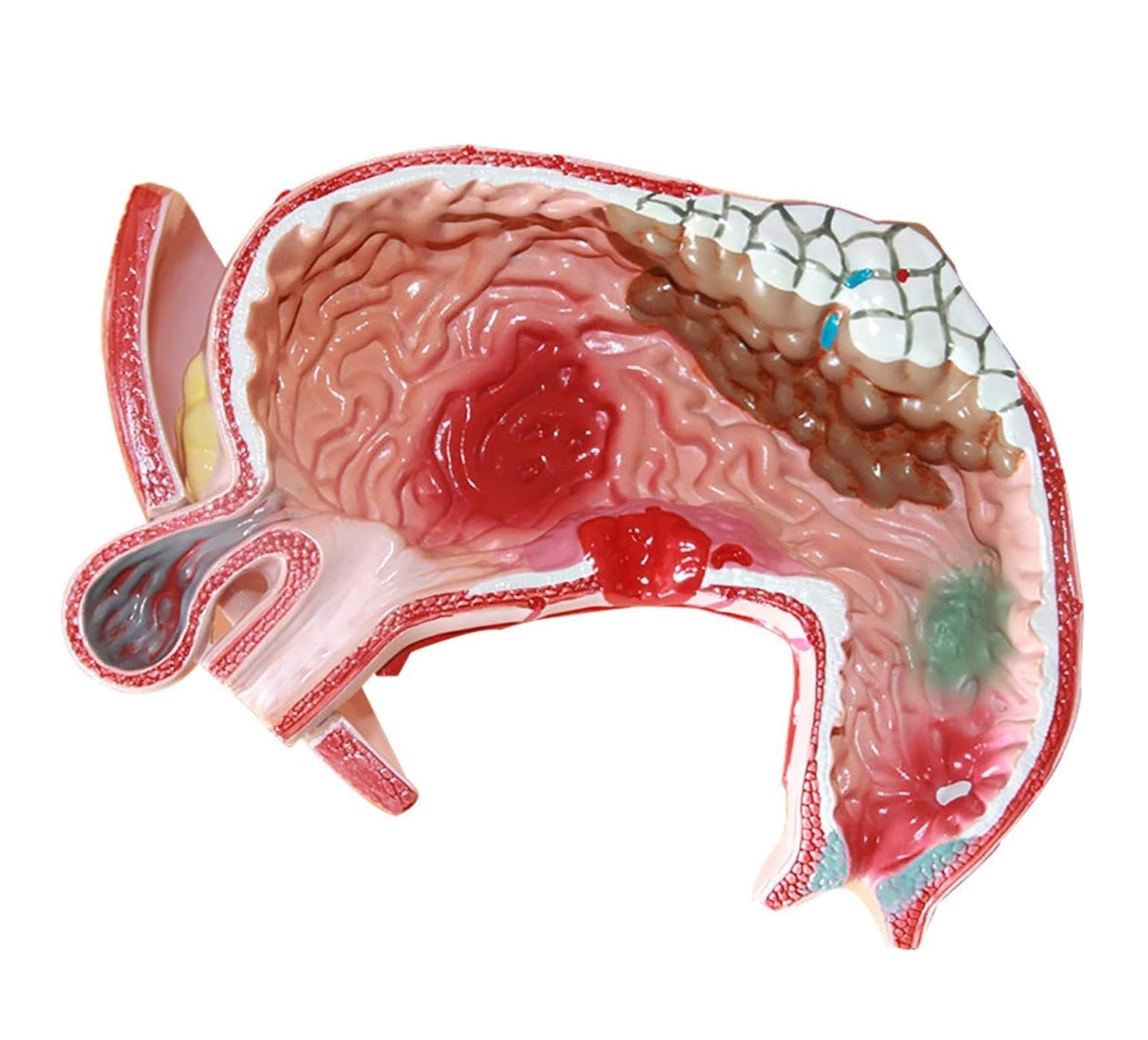 Model Człowieka Model Anatomiczny Ludzkiego Układu Trawiennego Żołądka Dla Lekarzy Medyczne Narzędzia Dydaktyczne Anatomia