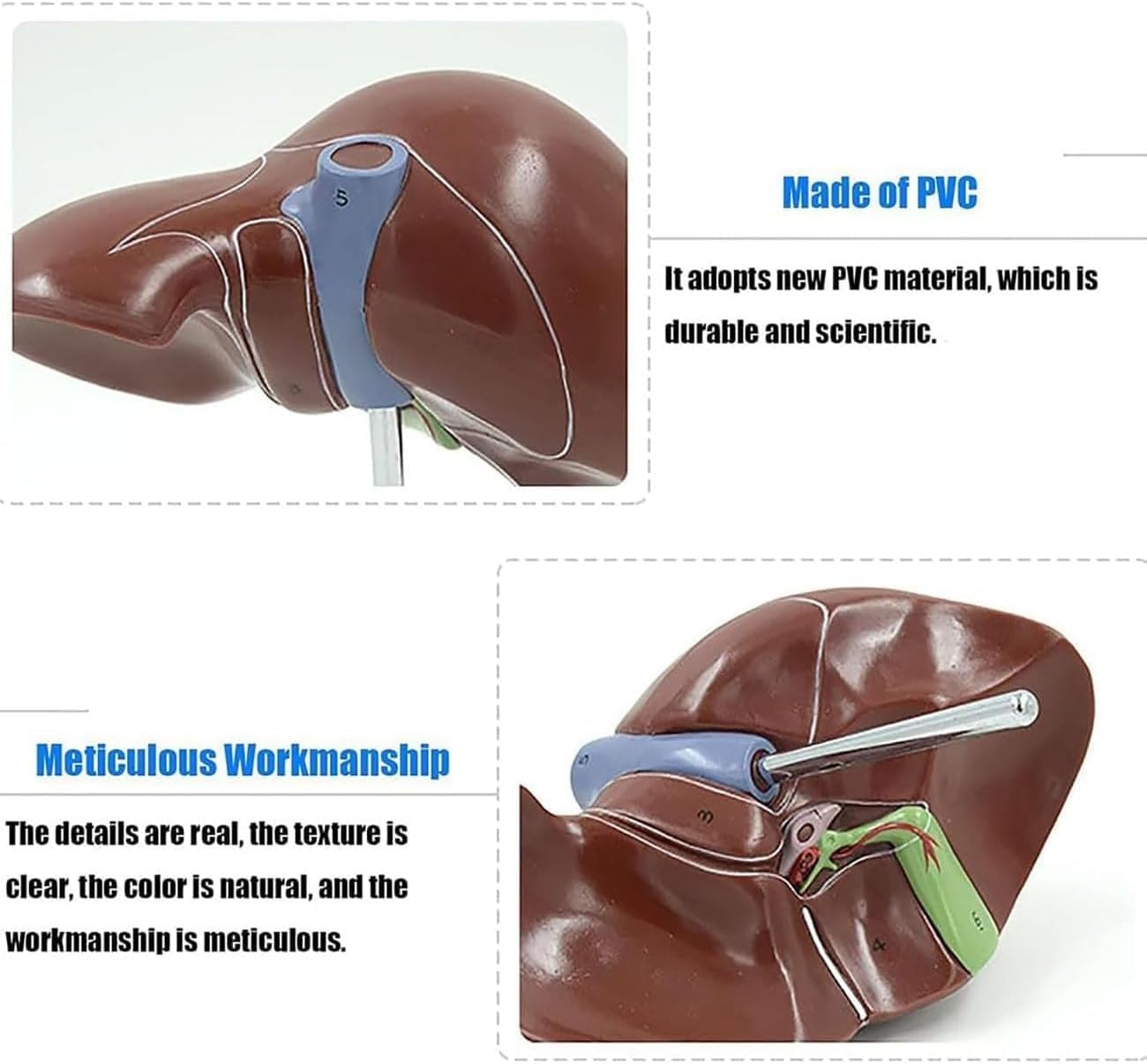 Modello di anatomia del fegato umano - Strumento didattico dettagliato per la patologia del pancreas e la dissezione del fegato per educazione medica, studenti e professionisti