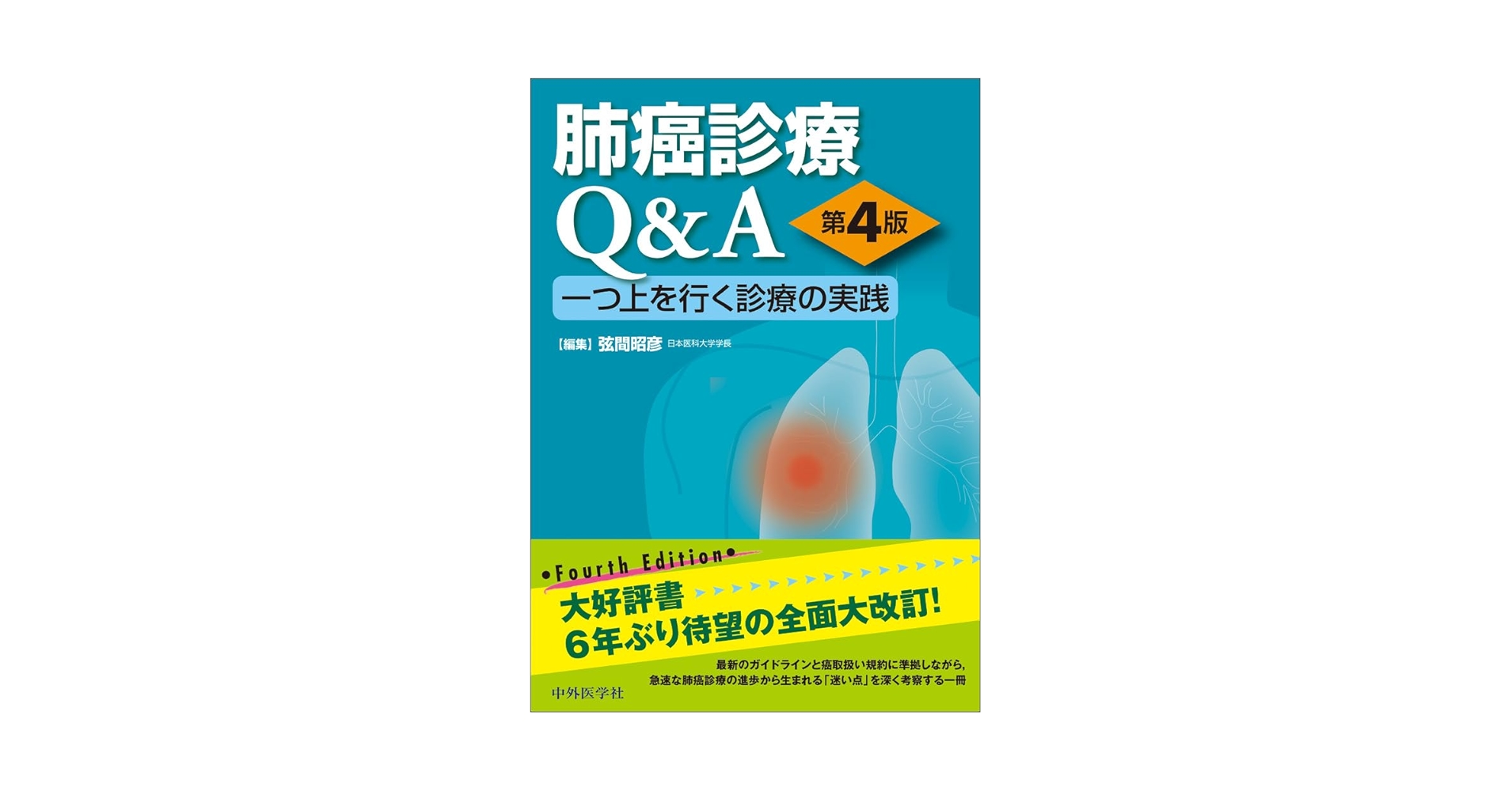 肺癌診療Q&amp;A 一つ上を行く診療の実践 第4版 肺癌診療Q&A 一つ上を行く診療の実践 第4版 / 高陽堂書店