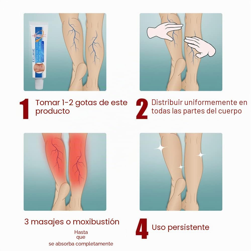 Veinshealth - Terapia de luz azul para venas varicosas (2 cremas + 1 bolígrafo)