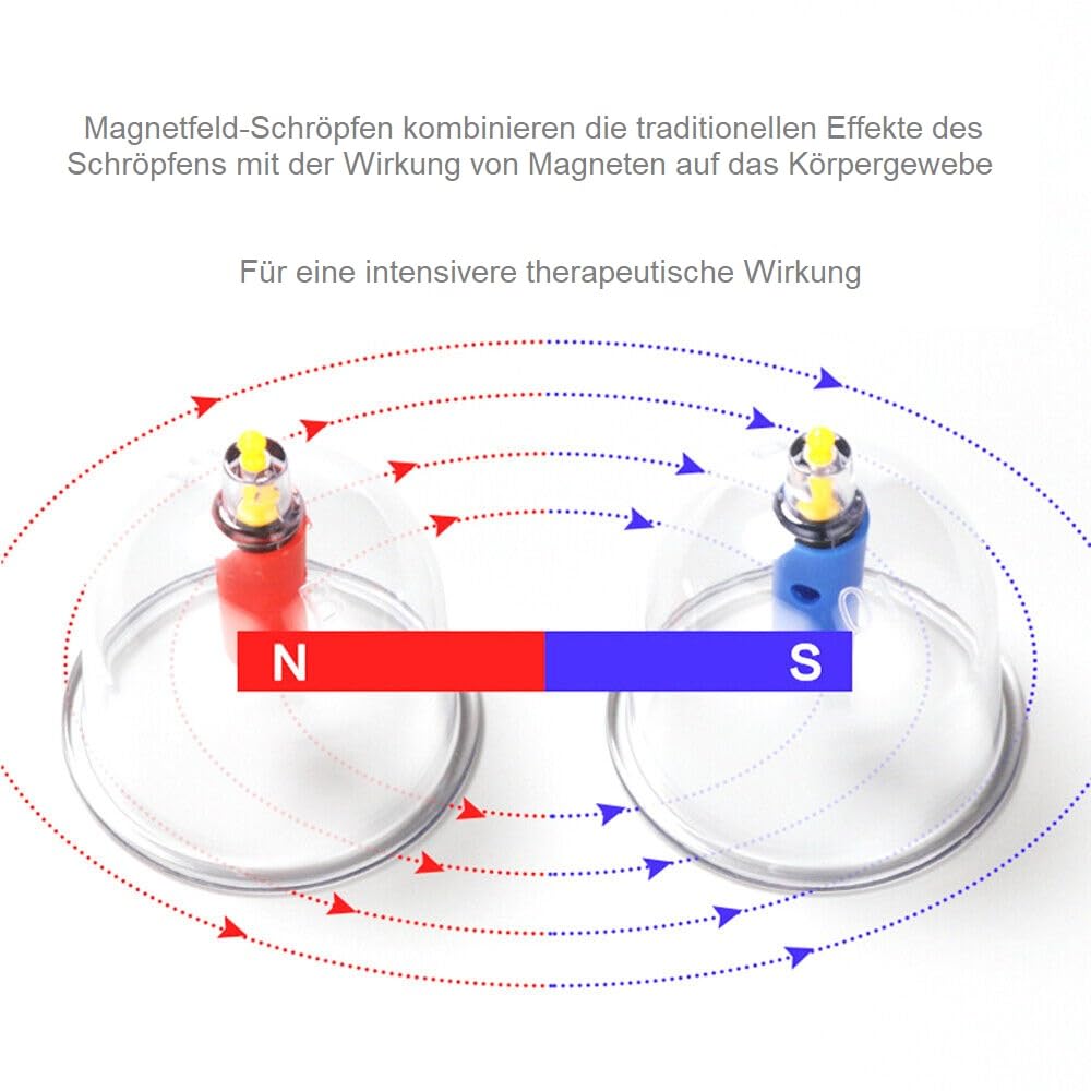 GMMH Zestaw 24 baniek do masażu próżniowego z bańkami biomagnetycznymi, tradycyjną chińską terapią, zestaw do rozbierania próżniowego