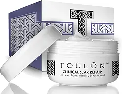 Creme de remoção de cicatrizes para melhor remover cicatrizes antigas e novas com manteiga de karité, vitamina C e óleo de tamanu
