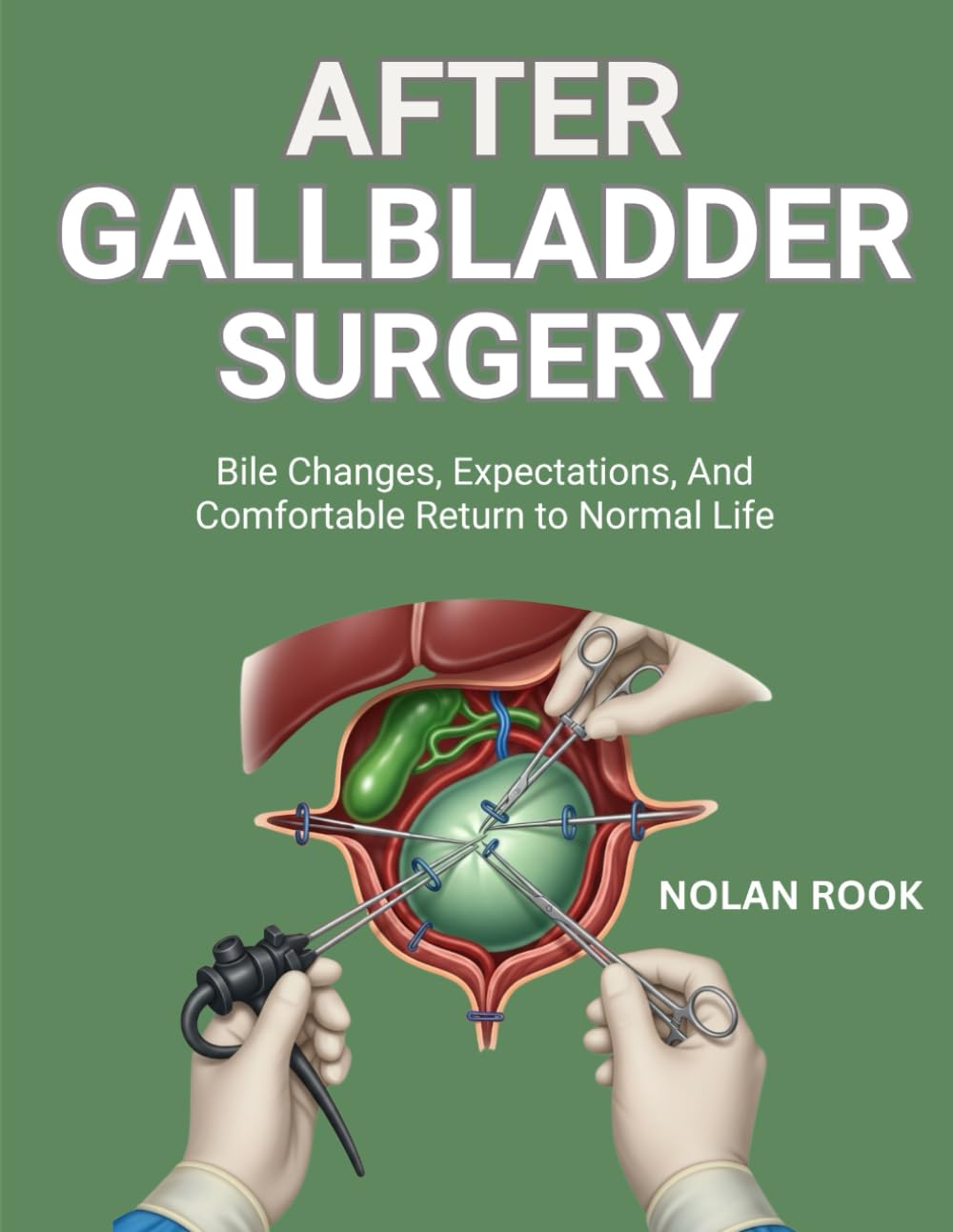 AFTER GALLBLADDER SURGERY: Bile changes, expectations, and comfortable return to normal life