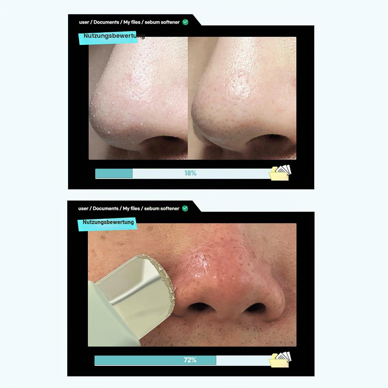 ILSO Super Melting Sebum Softener, 156 ml, mit 40 Baumwollpads inklusive