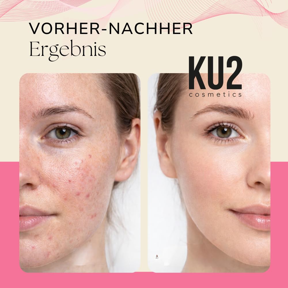 KU2 Cosmetics Niacinamide Serum Gesicht, 30 ml | Gegen Unreinheiten & große Poren, Ausgleichender Teint, Gesichtsserum gegen fettige & unreine Haut