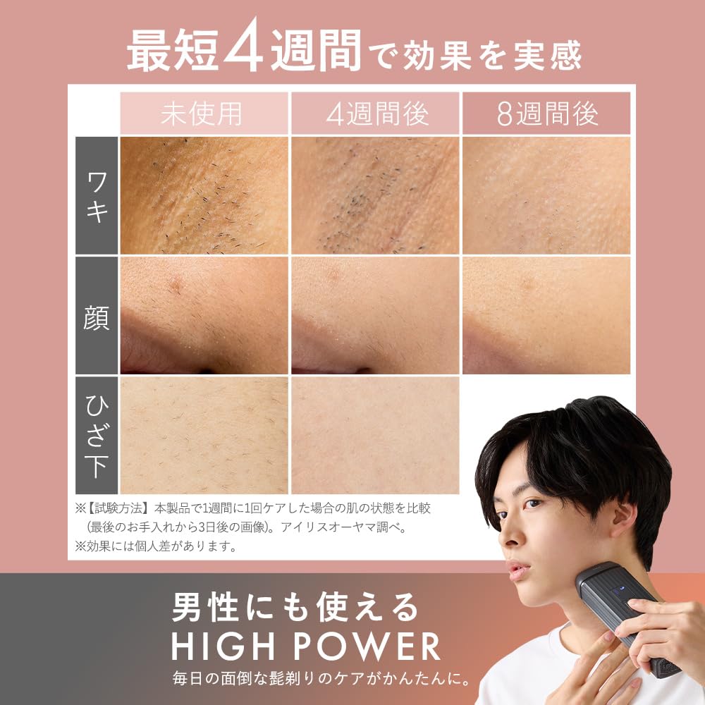 Amazon | 【MiCOLA】アイリスオーヤマ 脱毛器カテゴリ 光美容器