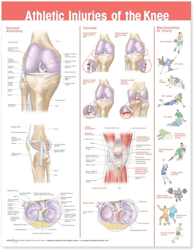 Athletic Injuries of The Knee Anatomical Chart