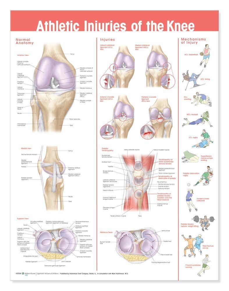 Athletic Injuries of The Knee Anatomical Chart