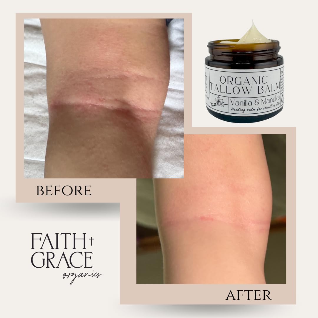 Faith and Grace Organics Beef Tallow Balm for Skin, Organic Tallow Cream with Vanilla and Manuka Honey, All-purpose Moisturizer for Face and Body- 2 oz - Image 3