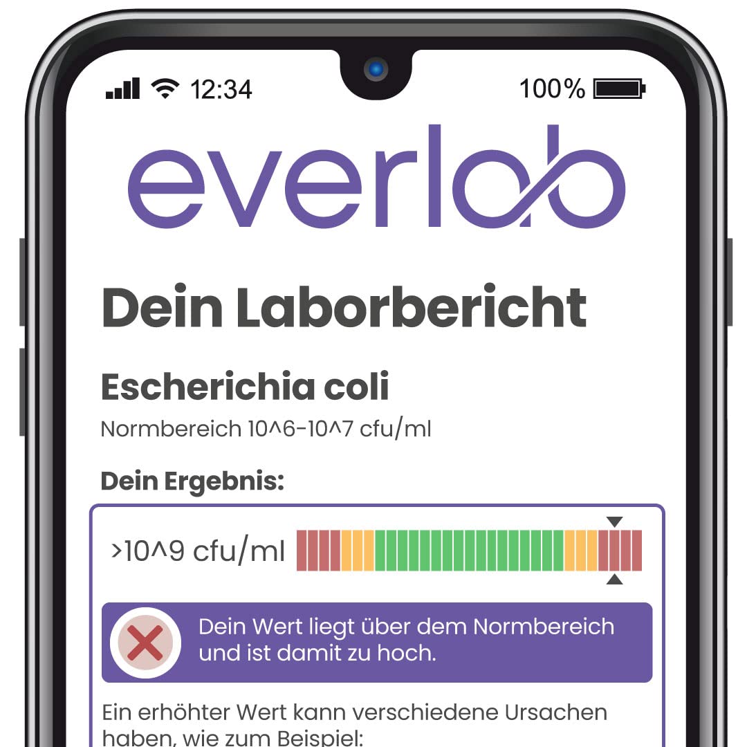 Darmgesundheits Test – Darmflora Plus Untersuchung auf Darmbakterien, Candida, Leaky Gut u.v.m. – Stuhltest – Selbsttest für Zuhause