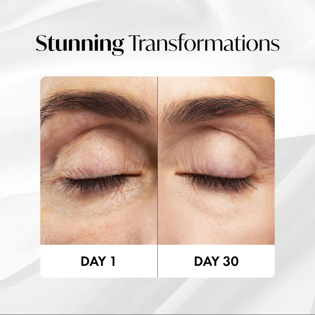 Azio Beauty Intense Lifting Eye Serum 15ml, Anti-Aging Reduces Puffiness, Eye Bags & Dark Circles, Visibly Younger Eye - Image 3