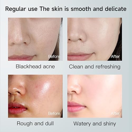 Miniatura 5 de VENROCK Tónico exfoliante de ácido glicólico al 7%, tóner diario iluminador y suavizante para un tono de piel de aspecto más uniforme, pH 3.6, 3.4