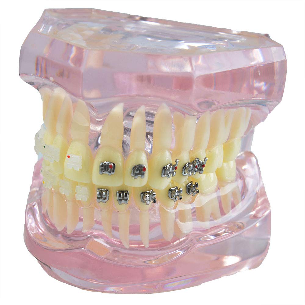 Modello didattico, Modello di denti per apparecchi dentali in metallo e ceramica, Modello ortodontico per adulti dentale Modello di denti dentali Dentista per strumenti di odontoiatria per studio di