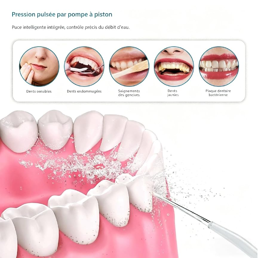 Oryzom Hydropulseur Sans fil Pour un Soin Dentaire & Buccal optimal - Jet Dentaire pour Gencives 5 Modes & 4 Embouts, Réservoir de 300 ml, Étanchéité IPX7, Prenez soin de votre Bouche (Noir)