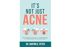 Clear Skin And A Healthier You: Beat Acne