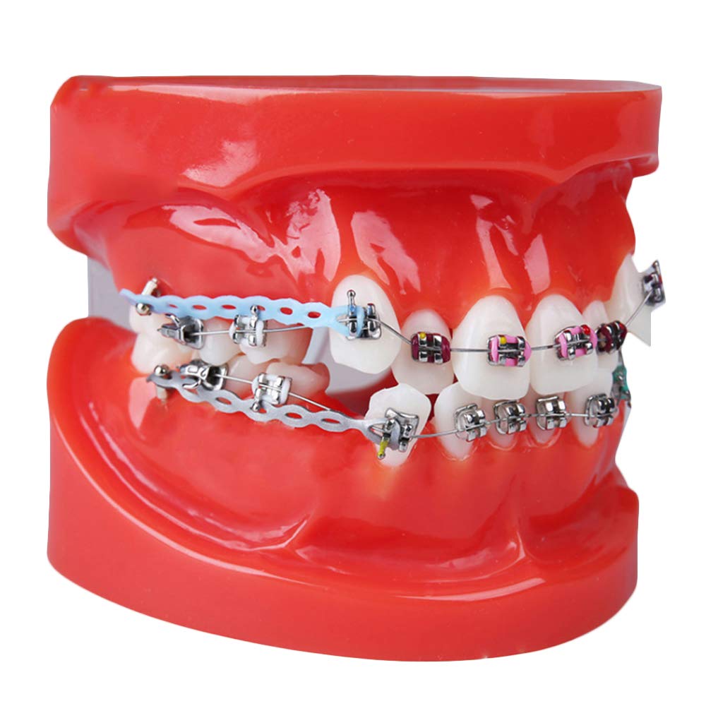 Dental Tipodonto Adulto Demostración Modelo de los Dientes con los Dientes Mental Brackets de ortodoncia Modelo con Ligadura Corbatas Rojas