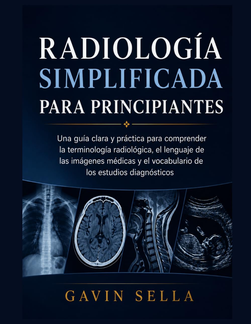 Radiología Simplificada para Principiantes: Una guía clara y práctica para comprender la terminología radiológica, el lenguaje de las imágenes médicas y el vocabulario de los estudios diagnósticos