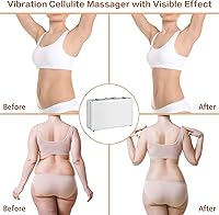 Vista 7 de Masajeador eléctrico de celulitis de vibración, masajeador de mano para eliminar celulitis, masajeador de cuerpo completo, masajeador de celulitis