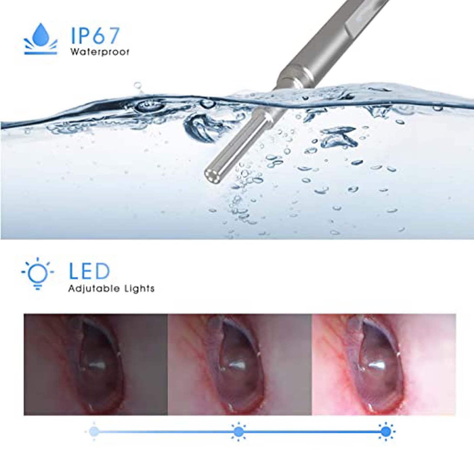 Otoscopio para Eliminación de Cera en Los Oídos de 3,9mm, Pala para la Oreja, Selección de Oreja Visible, Video HD y Foto, Otoscopio, Espejo Nasal, Endoscopio de Prueba Vaginal