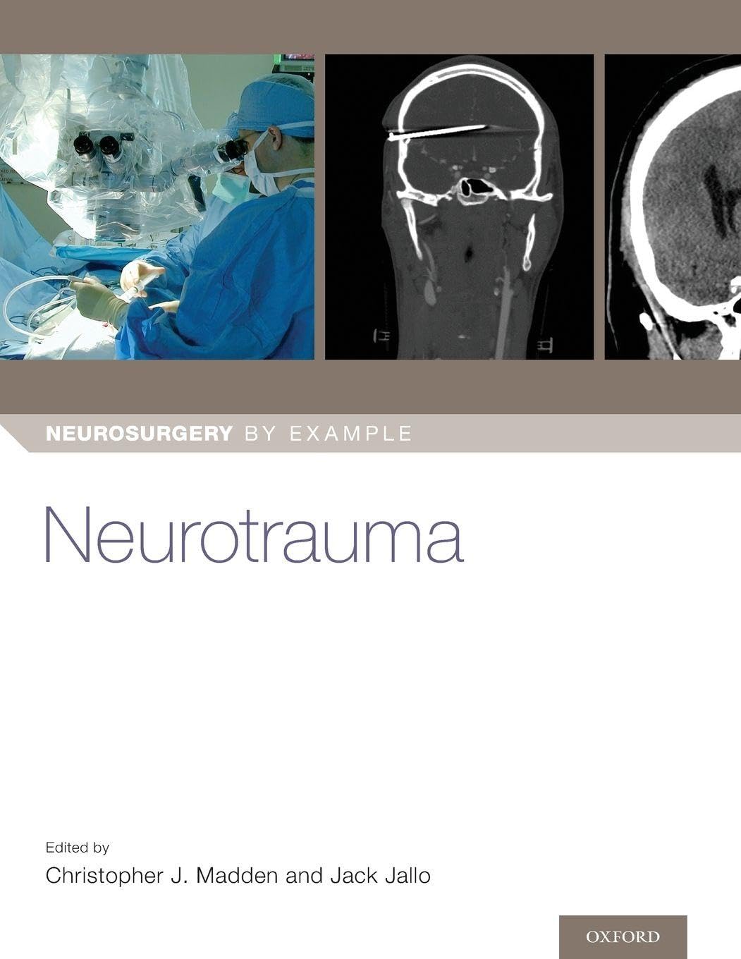 Buy Neurotrauma (Neurosurgery by Example) — BookShops.in