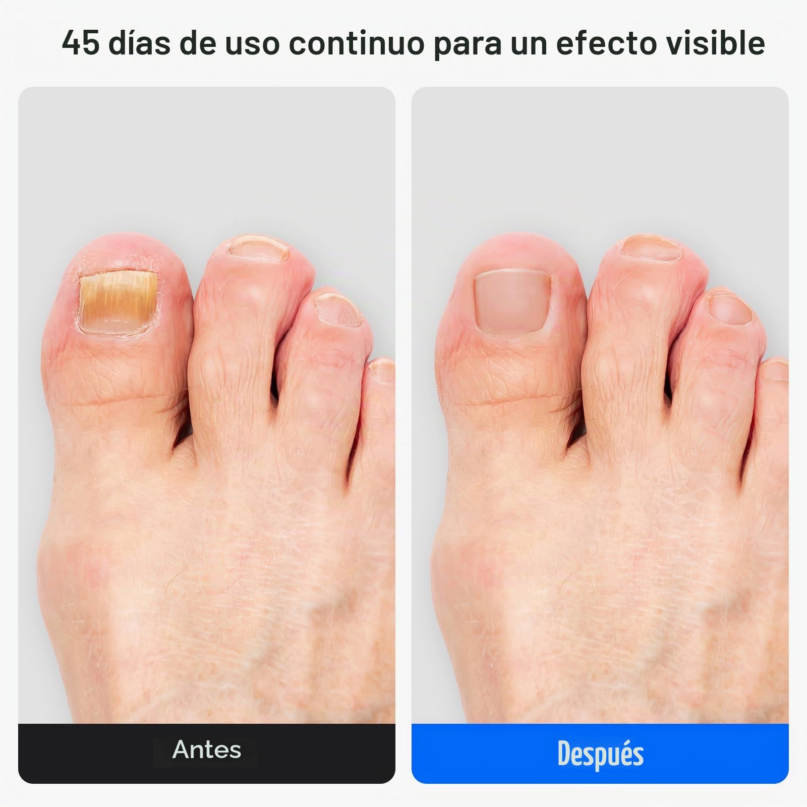 Aparato para el cuidado de las uñas (de pies y manos)