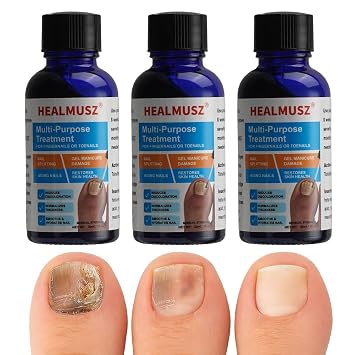 Toenail Fungus Treatment Extra Strength 3 Pack, 1 fl oz Each Athletes Foot Treatment for Toenails, Restorative Nail Repair for Damaged Nails Clinically Proven OTC Formula NDC 85248-058-01
