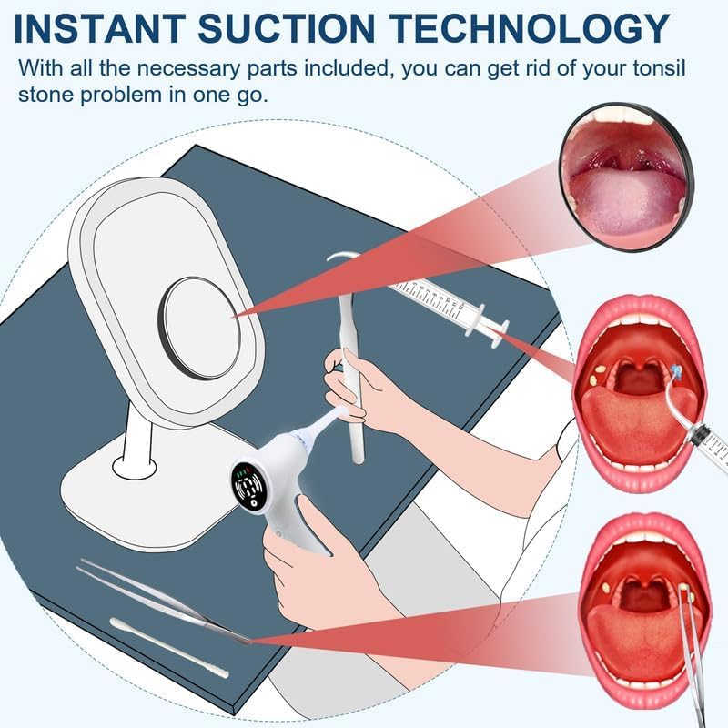 upgraded tonsil stone remover tool, upgraded electric tonsil stone removal kit - with built-in led light & 6-level suction for bad breath prevention, oral suction device for stone removal(off white)