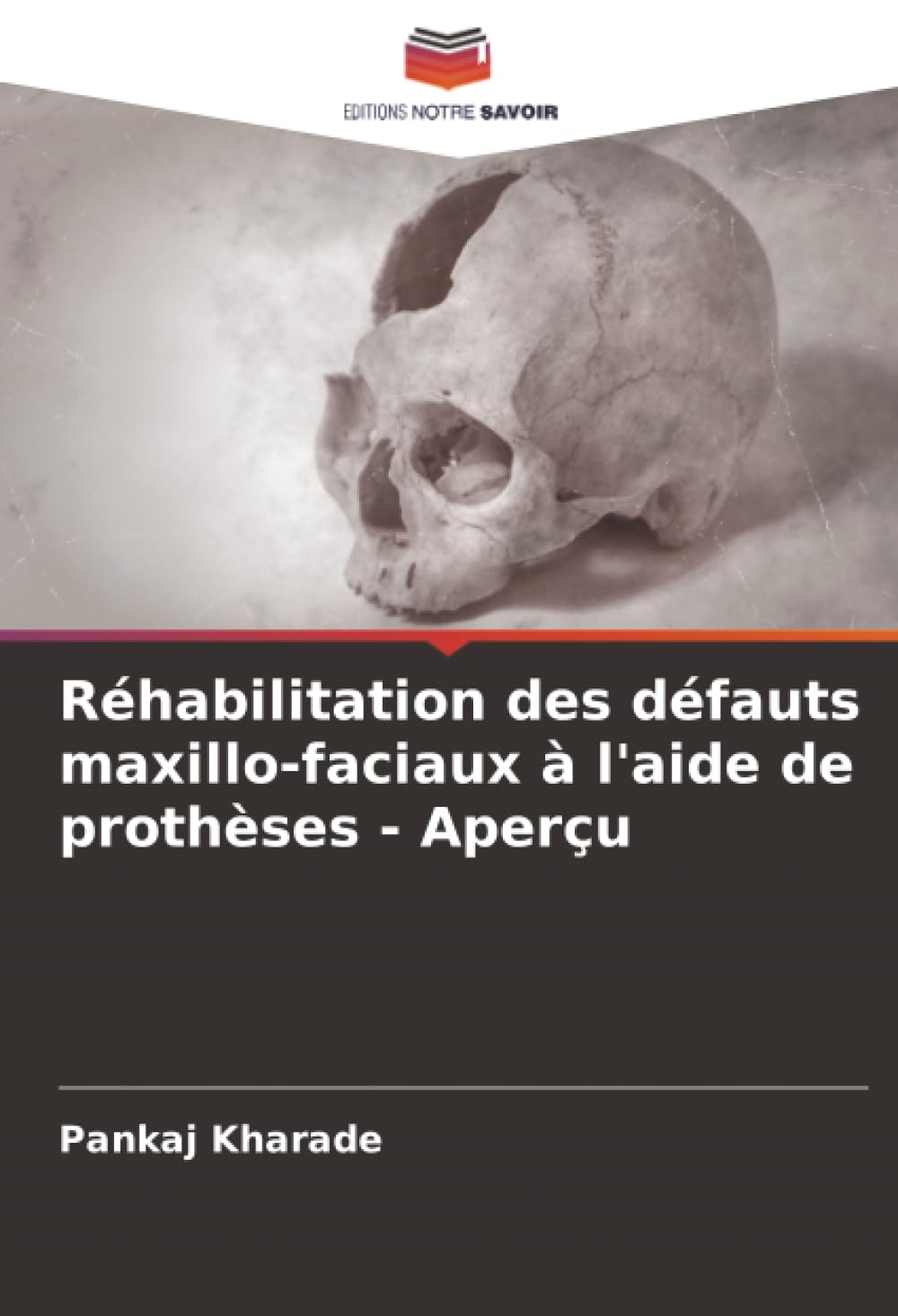 Réhabilitation des défauts maxillo-faciaux à l'aide de prothèses - Aperçu