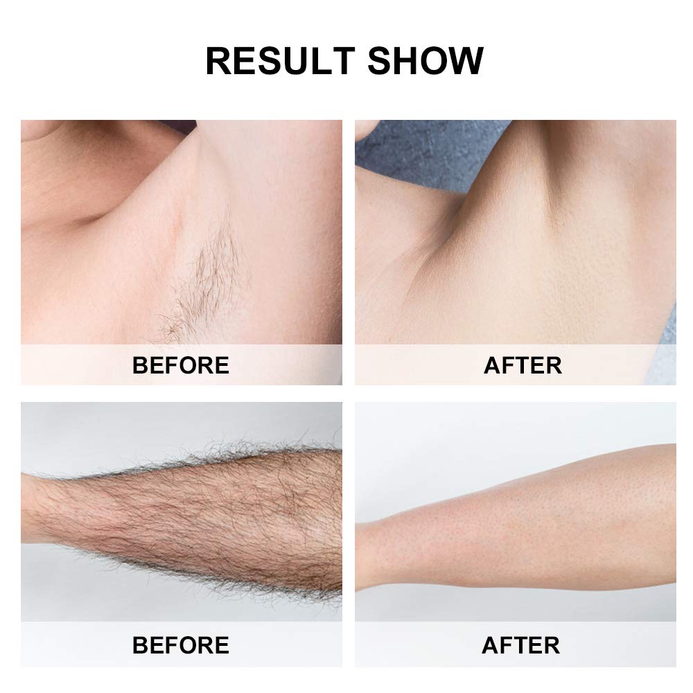 Sistema De Dispositivo De Depilación IPL Para Mujeres, Hombres, Depiladores 900,000 Flashes Sin Dolor Permanente Para La Cara Bikini Axilas Cuerpo Pierna